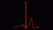 Heart Beat