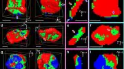 3D of Map Nanoscale Chemical Reactions Inside Batteries