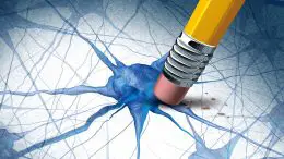 Alzheimers Dementia Brain Disease Concept