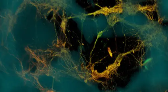 Bioengineers Create Functional 3D Brain Like Tissue