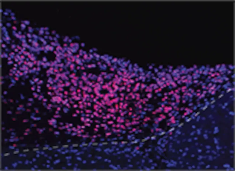 Border Between a Transplanted Human Brain Organoid and Mouse Brain