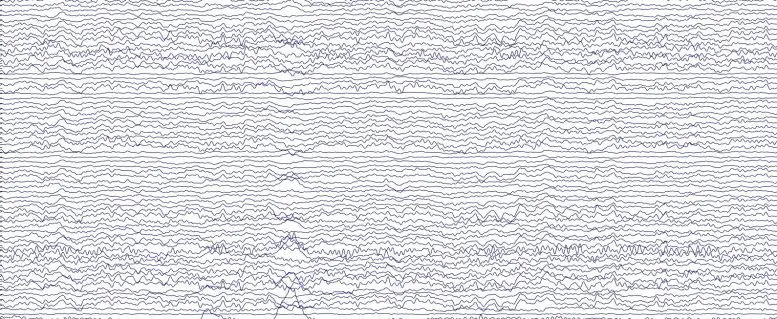 Brain Activity Recorded by EEG Cap