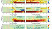 Brain Waves Anesthesia With Propofol