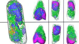 Cells Infected With SARS-CoV-2 Advanced Light Source