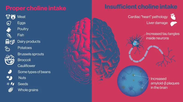 Choline Brain