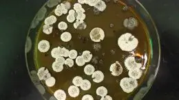 Common Bacteria Streptomyces