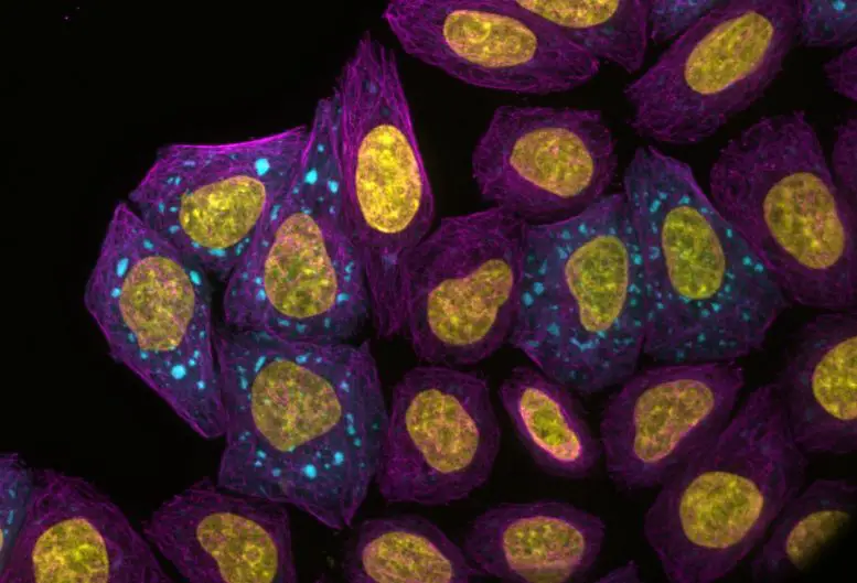 Fluorescence Microscopy Protein Condensates Forming