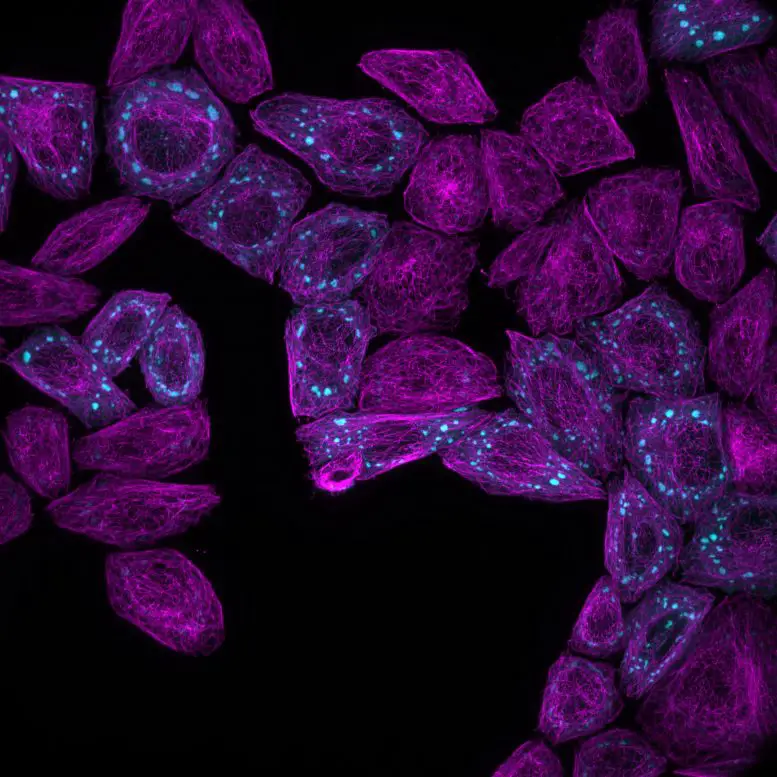 Fluorescence Microscopy Protein Condensates Forming Inside Living Cells