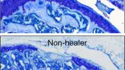 Genes Promote Cartilage Healing