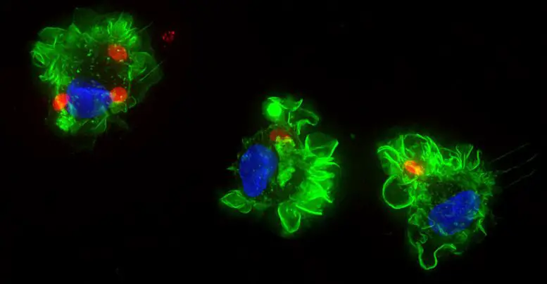 Immune Cell Infected by Toxoplasma Parasites