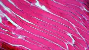 Muscle Fiber Cells