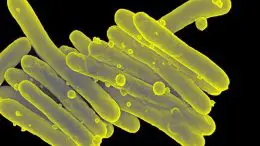 Mycobacterium Tuberculosis