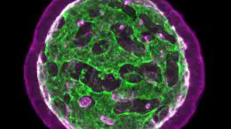 Neuroepithelial Organoids Architecture