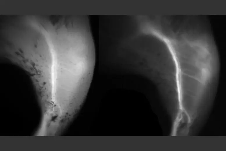 New Technique Generates Clearer Images of Blood Vessels