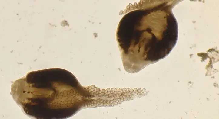 Bad News: Warming Oceans Have Decimated Marine Parasites