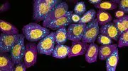 Protein Condensates Forming Inside Living Cells