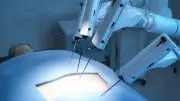 Robotic Surgery