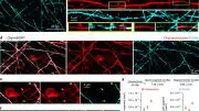 SCoRe Microscopy for Label-Free Myelin Imaging