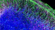 Single Neural Rosette-Derived Organoids