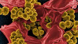 Staphylococcus aureus