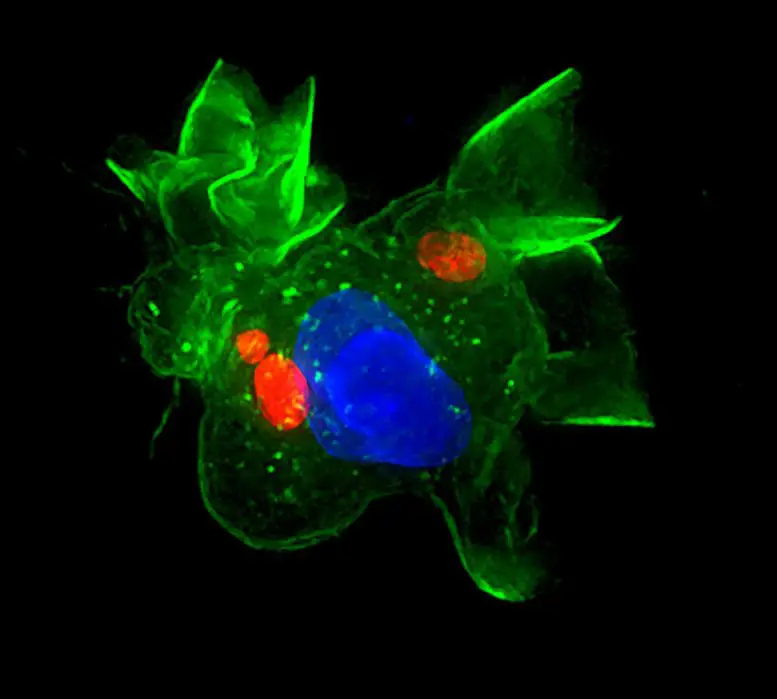 Toxoplasma Close Up