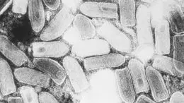 Vesicular Stomatitis Virus